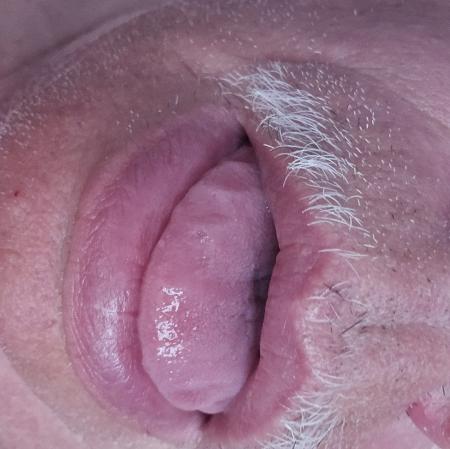 Photo de Bouche a disposition